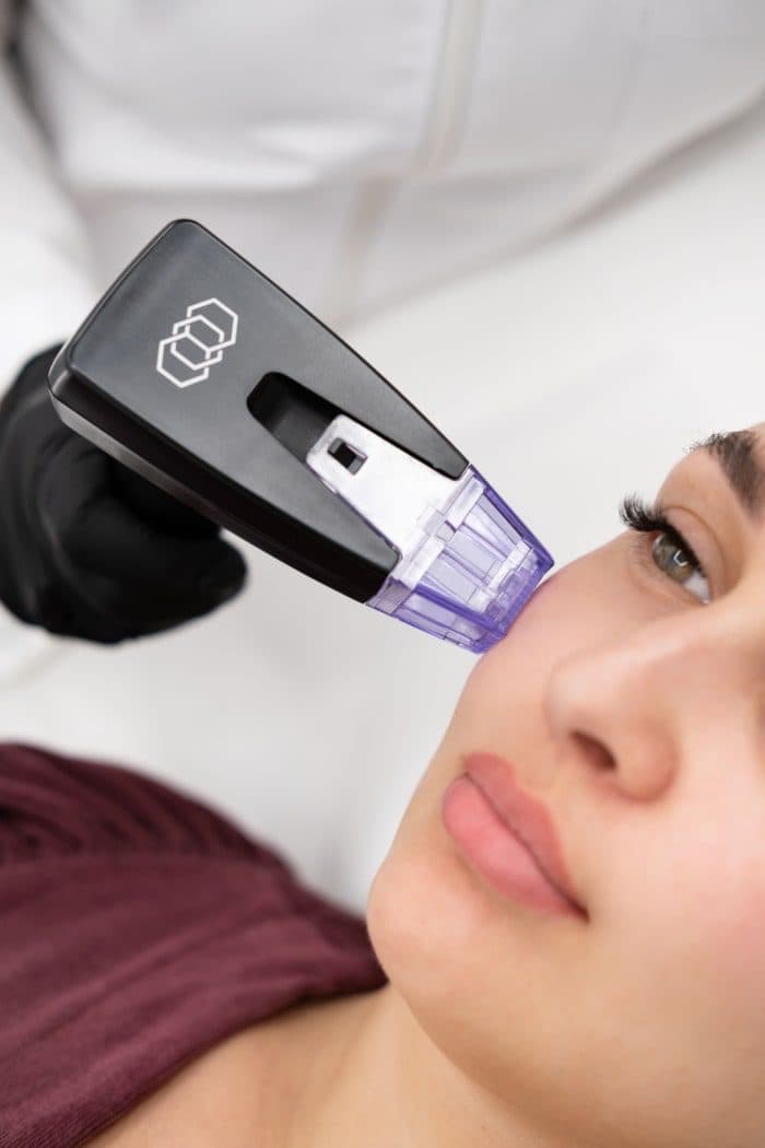 Skin Treatments